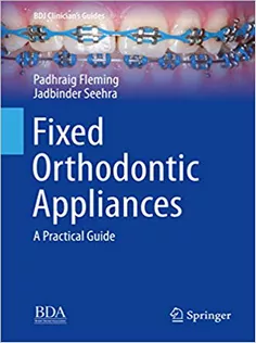 Fixed Orthodontic Appliances