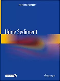 Urine Sediment
