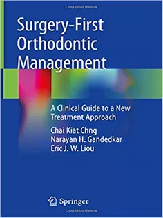 Surgery-First Orthodontic Management
