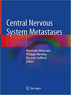 Central Nervous System Metastases