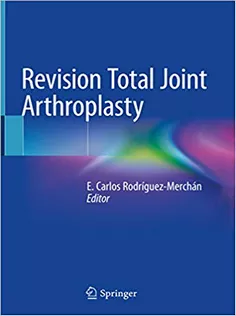 9783030247720 Revision Total Joint Arthroplasty