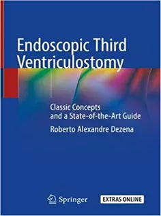 Endoscopic Third Ventriculostomy
