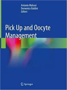 Pick Up and Oocyte Management
