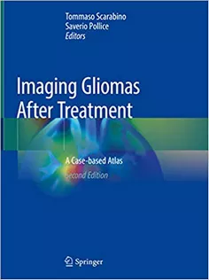 9783030312091 Imaging Gliomas After Treatment