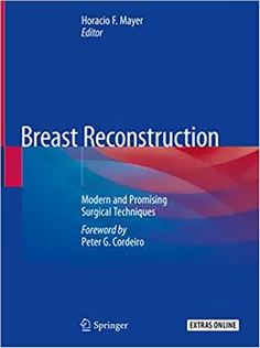 Breast Reconstruction: Modern and Promising Surgical Techniques
