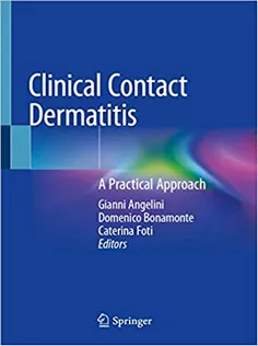 Clinical Contact Dermatitis: A Practical Approach