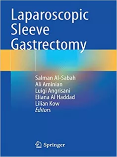 Laparoscopic Sleeve Gastrectomy
