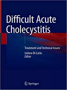 Difficult Acute Cholecystitis: Treatment and Technical Issues