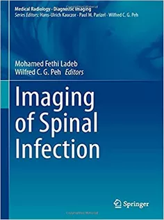 Imaging of Spinal Infection