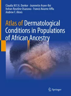 9783030726164 Atlas of Dermatological Conditions in Populations of African Ancestry