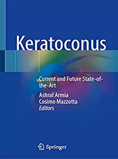 Keratoconus Current and Future State-of-the-Art