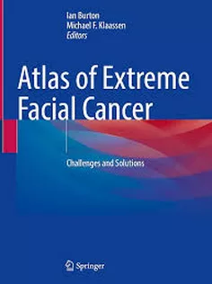 Atlas of Extreme Facial Cancer: Challenges and Solutions