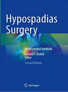 Hypospadias Surgery: An Illustrated Textbook