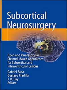 Subcortical Neurosurgery: Open and Parafascicular Channel-Based Approaches for Subcortical and Intraventricular Lesions