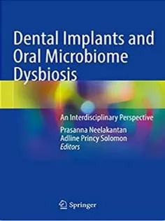 Dental Implants and Oral Microbiome Dysbiosis
