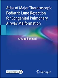 9783031079368 Atlas of Major Thoracoscopic Pediatric Lung Resection for Congenital Pulmonary Airway Malformation
