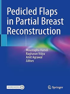 Pedicled Flaps in Partial Breast Reconstruction