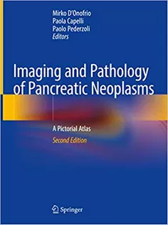 Imaging and Pathology of Pancreatic Neoplasms: A Pictorial Atlas