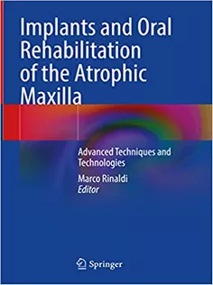 Implants and Oral Rehabilitation of the Atrophic Maxilla