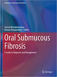Oral Submucous Fibrosis: A Guide to Diagnosis and Management