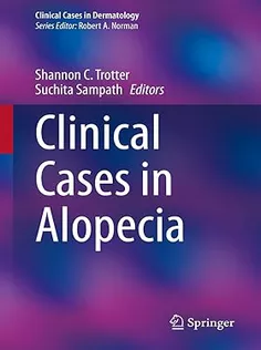 Clinical Cases in Alopecia