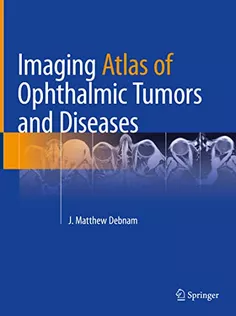 9783031174780 Imaging Atlas of Ophthalmic Tumors and Diseases
