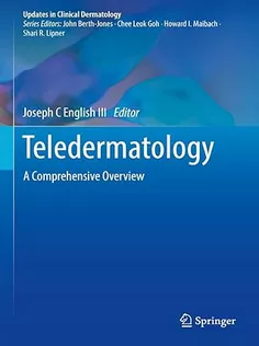 Teledermatology: A Comprehensive Overview