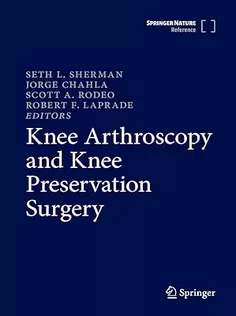 Knee Arthroscopy and Knee Preservation Surgery