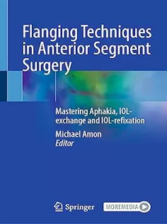 9783031328541 Flanging Techniques in Anterior Segment Surgery: Mastering Aphakia, IOL-exchange and IOL-refixation