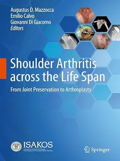 9783031332975 Shoulder Arthritis Across the Life Span
