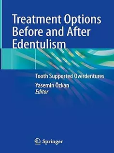 Treatment Options Before and After Edentulism