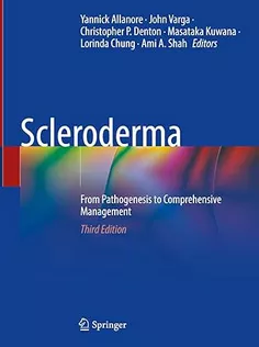Scleroderma: From Pathogenesis to Comprehensive Management