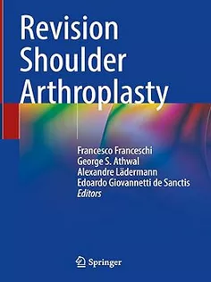Revision Shoulder Arthroplasty