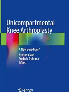 9783031483318 Unicompartmental Knee Arthroplasty: A New Paradigm?