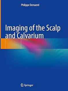 Imaging of the Scalp and Calvarium