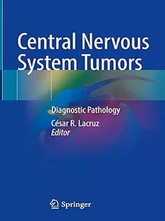 9783031510779 Central Nervous System Tumors: Diagnostic Pathology