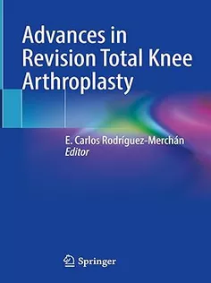 9783031604447 Advances in Revision Total Knee Arthroplasty