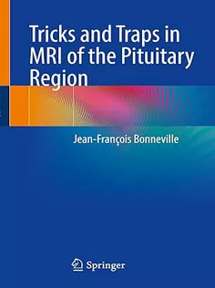 9783031647093 Tricks and Traps in MRI of the Pituitary Region