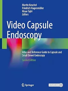 Video Capsule Endoscopy: Atlas and Reference Guide to Capsule and Small Bowel Endoscopy
