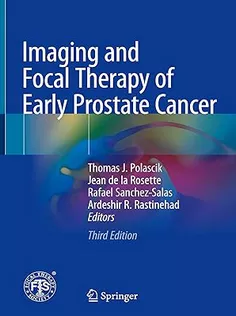 Imaging and Focal Therapy of Early Prostate Cancer