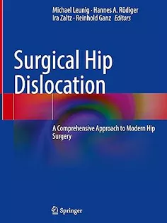 9783031706219 Surgical Hip Dislocation: A Comprehensive Approach to Modern Hip Surgery