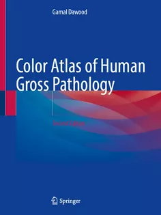 Color Atlas of Human Gross and Microscopic Pathology