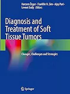 Diagnosis and Treatment of Soft Tissue Tumors