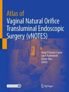 Atlas of Vaginal Natural Orifice Transluminal Endoscopic Surgery