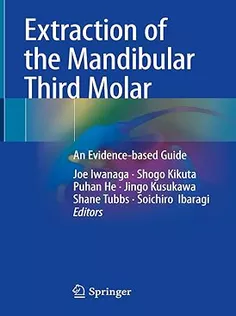 Extraction of the Mandibular Third Molar: An Evidence-based Guide
