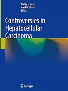 Controversies in Hepatocellular Carcinoma