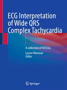 9783031970290 ECG Interpretation of Wide QRS Complex Tachycardia A Collection of 50 ECGs