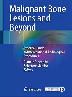 Malignant Bone Lesions and Beyond: Practical Guide to Interventional Radiological Procedures