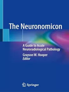 The Neuronomicon: A Guide to Acute Neuroradiological Pathology
