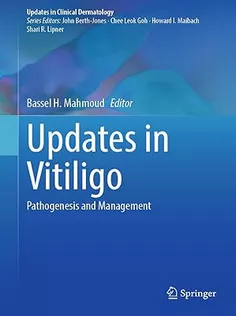 Updates in Vitiligo Updates in Vitiligo: Pathogenesis and Management